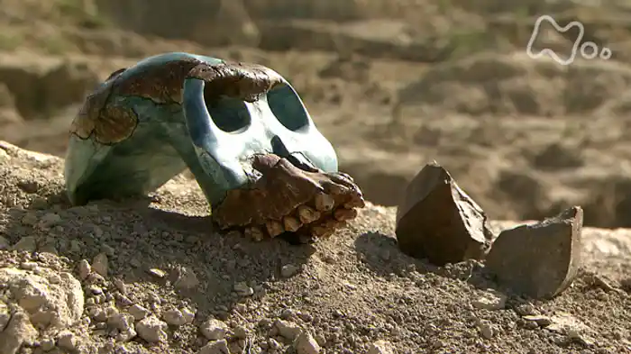 NHKスペシャル 病の起源 2 骨と皮膚の病 ~それは“出アフリカ”に始まった~