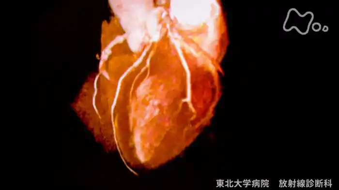 病の起源 心臓病~高性能ポンプの落とし穴~