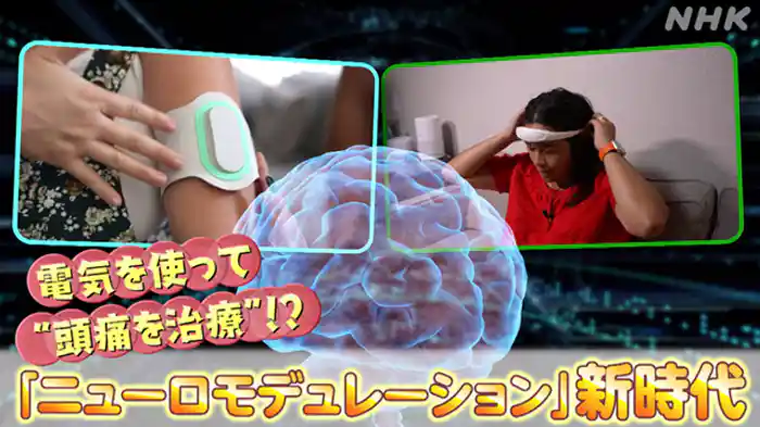 電気を使って“頭痛治療”！？ニューロモデュレーション新時代