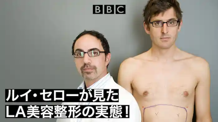 ルイ・セローが見た LA美容整形の実態!