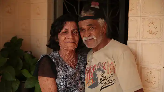 異常なまでの顔の腫れ