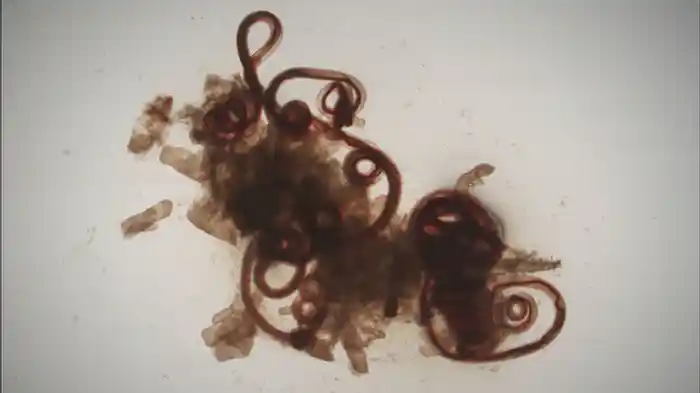 サナダムシの世界 キモ美しきその存在は善か悪か