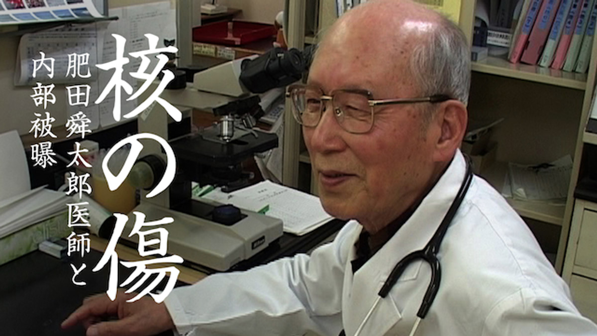 核の傷 肥田舜太郎医師と内部被曝