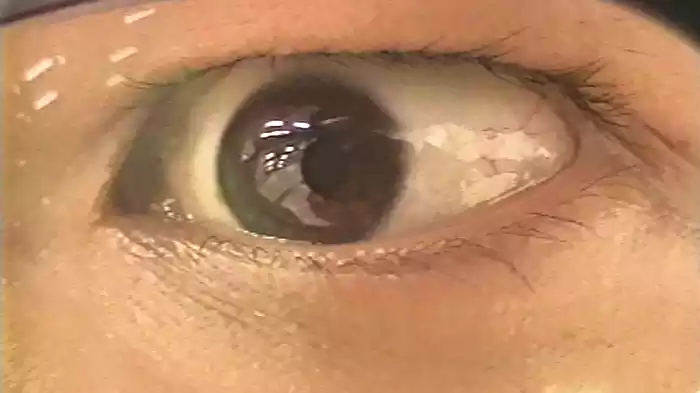 背
